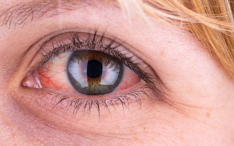 Olhos vermelhos ajudam a diagnosticar doenças