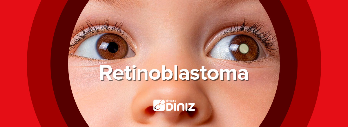 Montagem com bebê com retinoblastoma no centro.